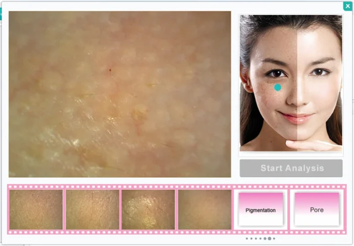 Machine de EAU facial 1